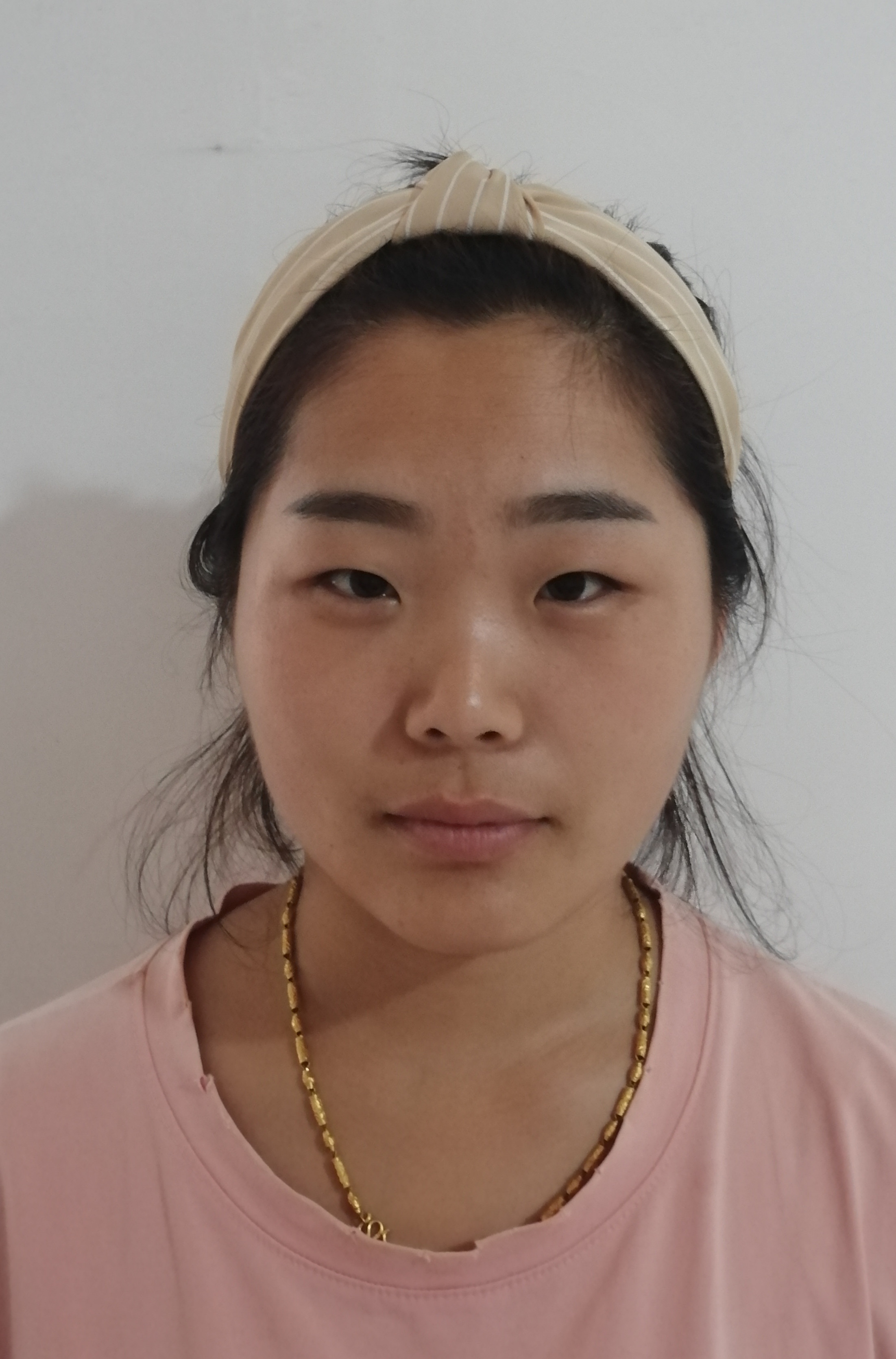 孙悦（女）养老护理