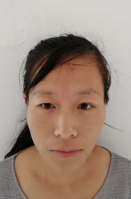 高敏（女）养老护理